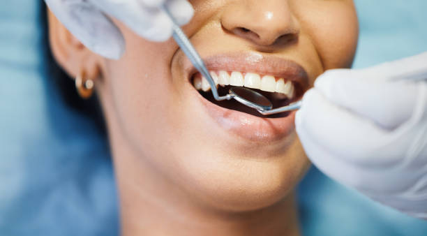Best Emergency TMJ Treatment in Rancho Mission Viejo, CA